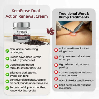 ✨Flash Sale - KeraErase Dual-Action Renewal Cream