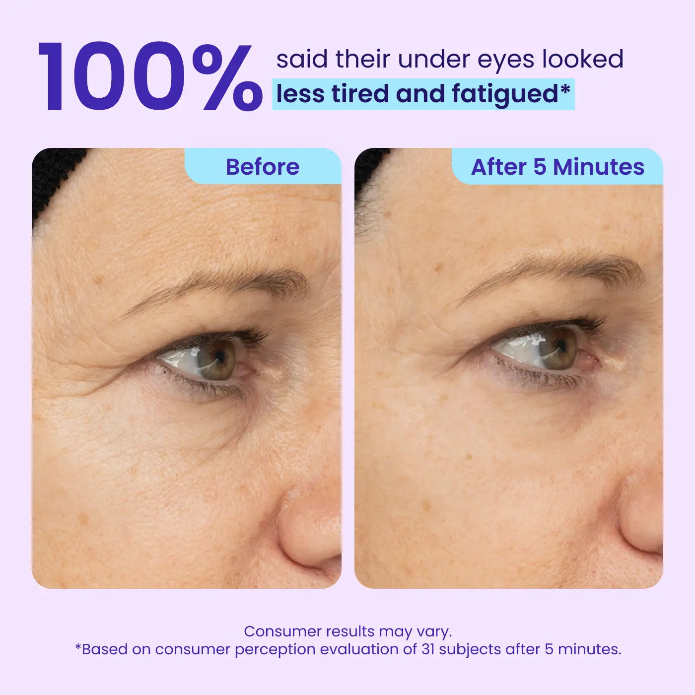Final 3 Hours: 60%OFF🔥🌿 Instant Lift Eye Gel for Puffiness, Bags & Dark Circles