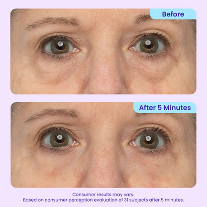 Final 3 Hours: 60%OFF🔥🌿 Instant Lift Eye Gel for Puffiness, Bags & Dark Circles