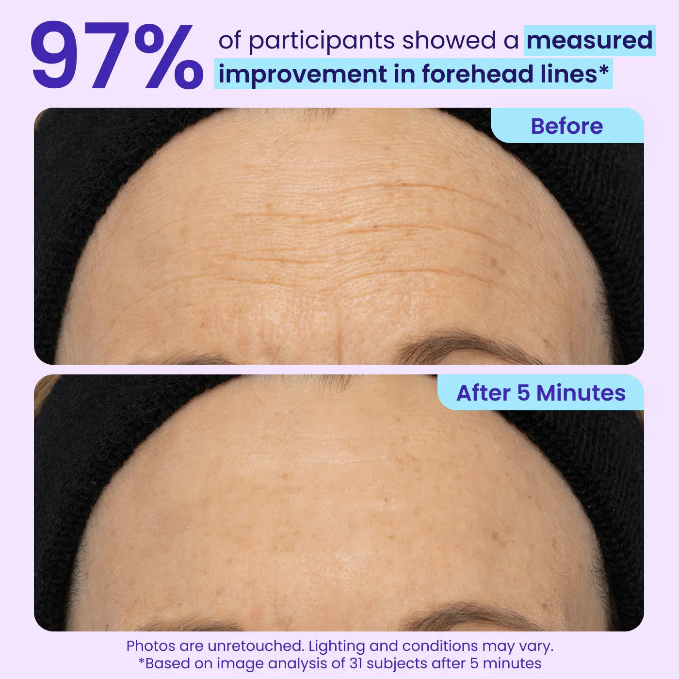 Final 3 Hours: 60%OFF🔥🌿 Instant Lift Eye Gel for Puffiness, Bags & Dark Circles