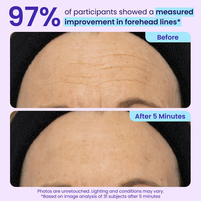 Final 3 Hours: 60%OFF🔥🌿 Instant Lift Eye Gel for Puffiness, Bags & Dark Circles